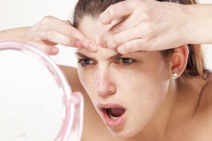 Penyebab Bruntusan di Jidat