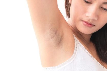 Cara Mencerahkan Ketiak Hitam